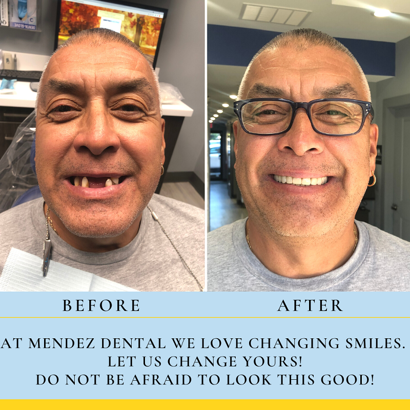 before and after case study
