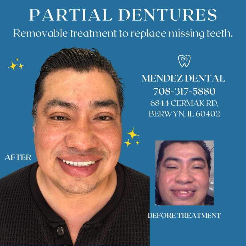 before and after case study